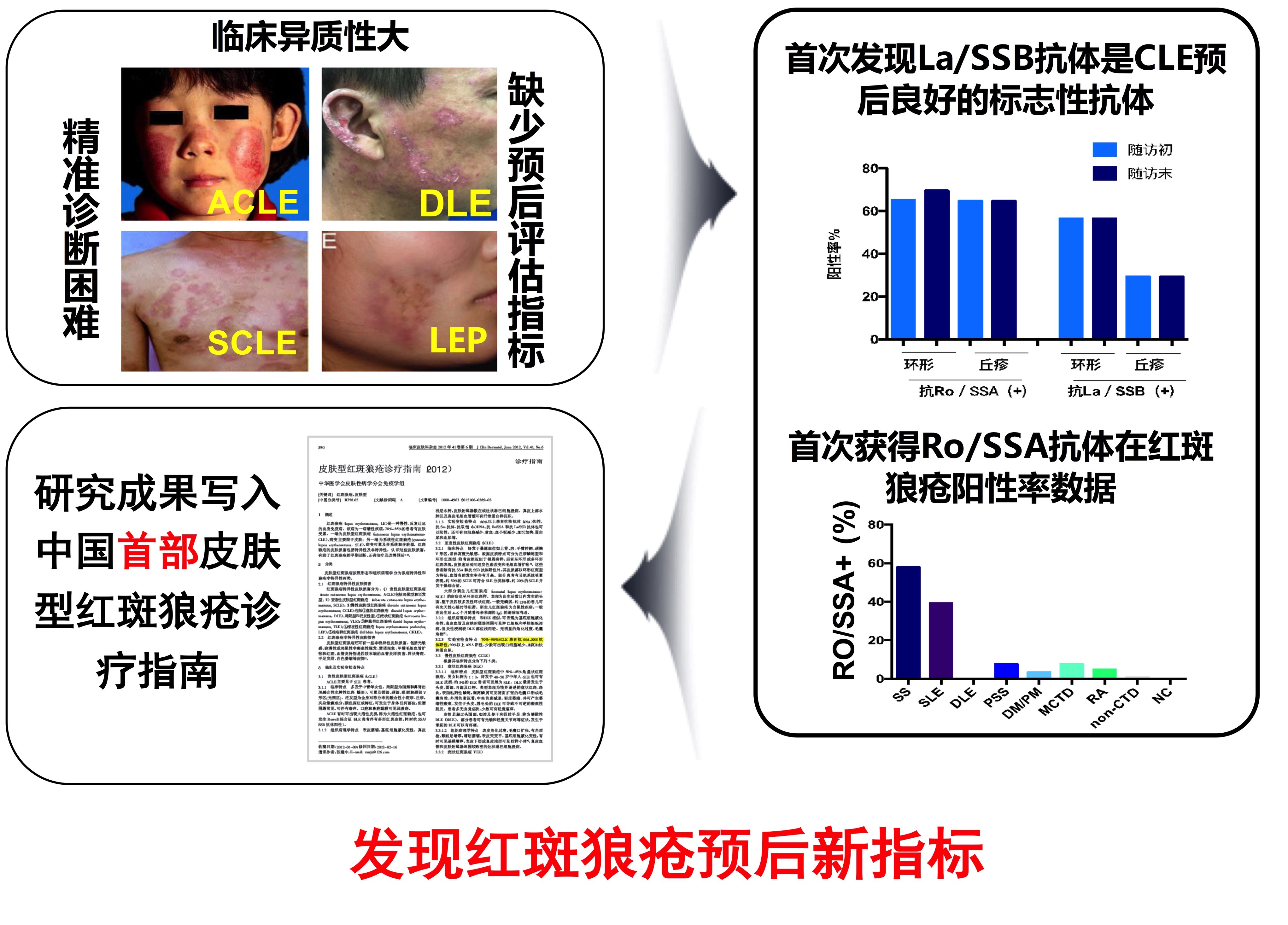 红斑狼疮的最新报道，研究、治疗与未来展望